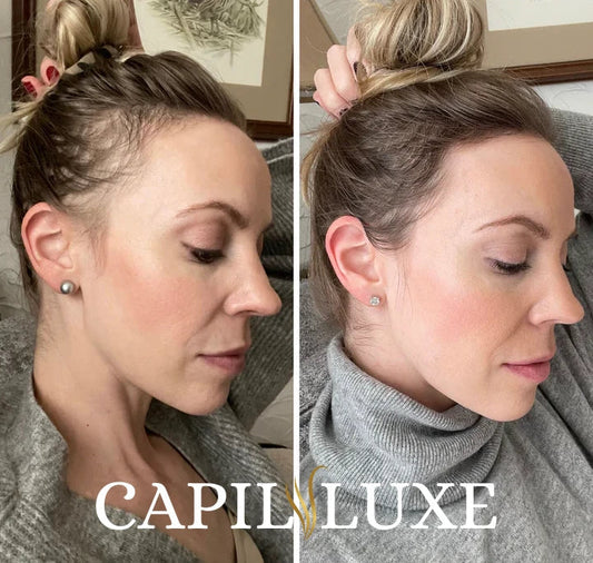 CapilLuxe™ | Révélez vos Cheveux Magnifiques : 1#  Le Shampooing Régénérateur Anti-Perte !